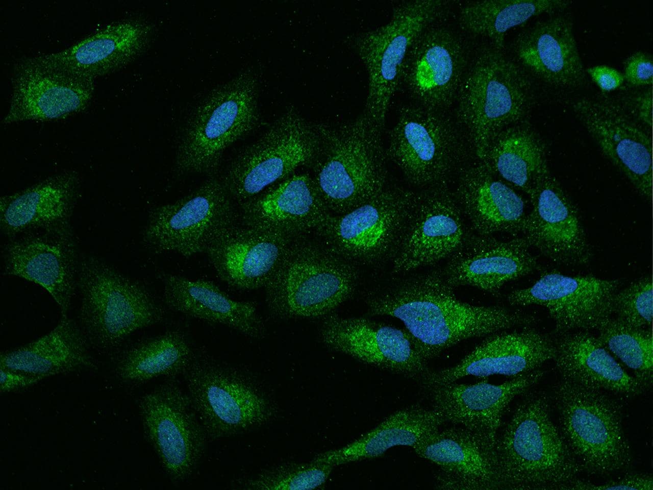 MTG1 / Mitochondrial GTPase 1 Antibody