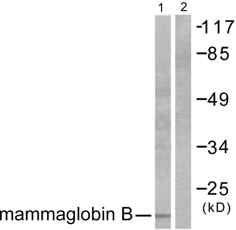 IHC-plus™ SCGB2A1 / Mammaglobin B Antibody (aa10-59)