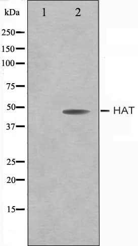 Polyclonal Rabbit anti-Human HAT1 Antibody (IF, WB)