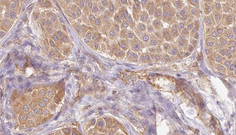 PAEP / Glycodelin / GdF Antibody