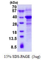 Human RWDD1 Protein (Recombinant His)