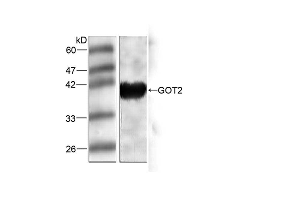 Monoclonal Mouse anti-Human GOT2 Antibody (aa25-430, WB)