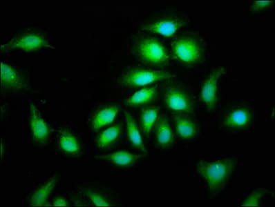 Polyclonal Rabbit anti-Human CEP135 Antibody (IF)