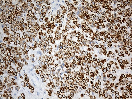 SYNE1 / Nesprin 1 Antibody (aa1-285, clone OTI1E10)