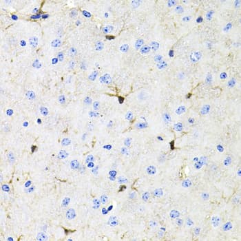 Polyclonal Rabbit anti-Human ACVR2 / ACVR2A Antibody (IHC, WB)