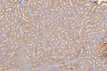 Polyclonal Rabbit anti-Human SFRP1 Antibody (IHC, WB)