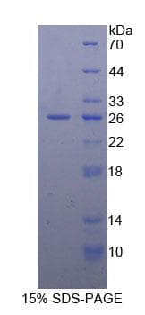 Mouse BCL2 / Bcl-2 Protein (Recombinant His-GST)