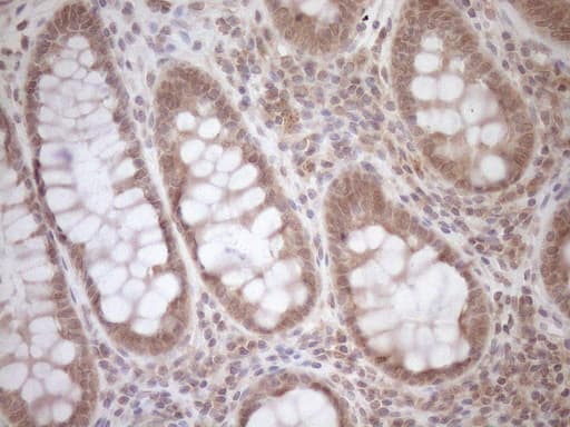 TCP10 Antibody (clone OTI2C2, Carrier-free)