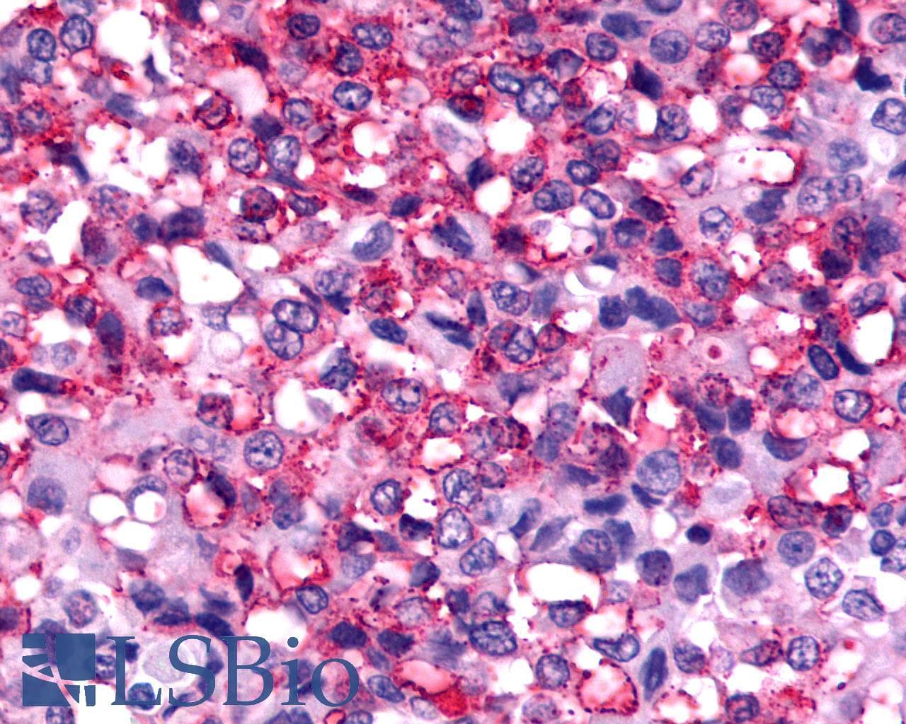 IHC-plus™ Polyclonal Rabbit anti-Human FZD2 / Frizzled 2 Antibody (N-Terminus, IHC)