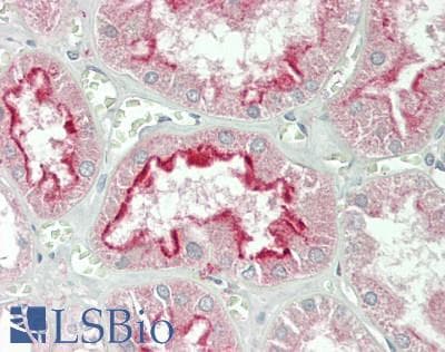Polyclonal Rabbit anti-Human FOLR1 / Folate Receptor Alpha Antibody (aa25-234, IHC, WB)