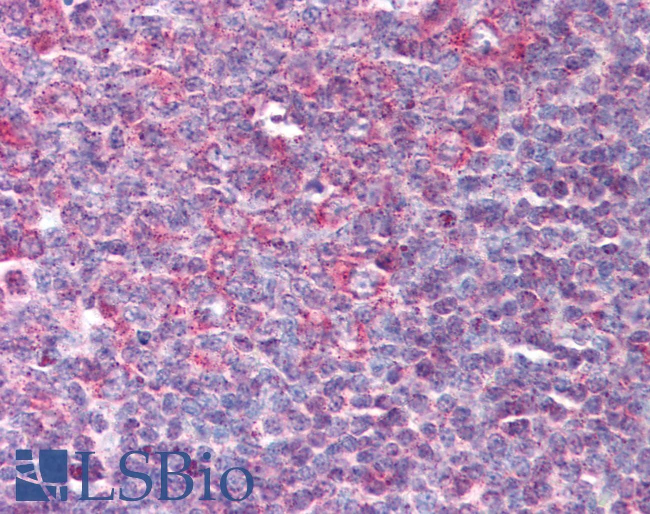 IHC-plus™ Polyclonal Rabbit anti-Human DEFB3 / Beta Defensin 3 Antibody (IHC)
