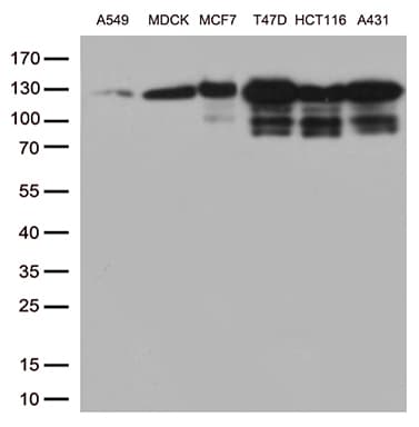 CDH1 / E Cadherin Antibody (clone UMAB184)