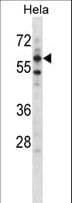 Polyclonal Rabbit anti-Human ADCK5 Antibody (aa94-121, WB)