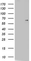 Monoclonal Mouse anti-Human CD5 Antibody (clone OTI8C10, WB)