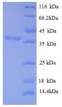Human RPLP2 Protein (Recombinant GST)