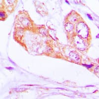 PNPT1 Antibody (C-Terminus)