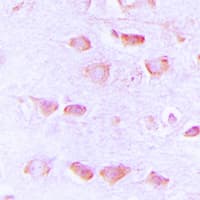 Polyclonal Rabbit anti-Human HRH3 / Histamine 3 Receptor Antibody (Internal, IHC, WB)