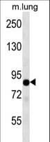 TLE2 Antibody (aa637-665)