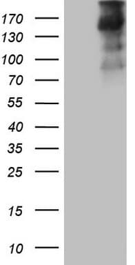 TG / Thyroglobulin Antibody (aa20-358, clone OTI8E4, Carrier-free)