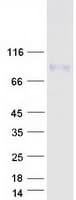 Human FAM55B Protein (Recombinant Myc-DDK (Flag))