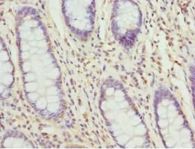 Polyclonal Rabbit anti-Human TAGLN2 / Transgelin 2 Antibody (IHC, WB)
