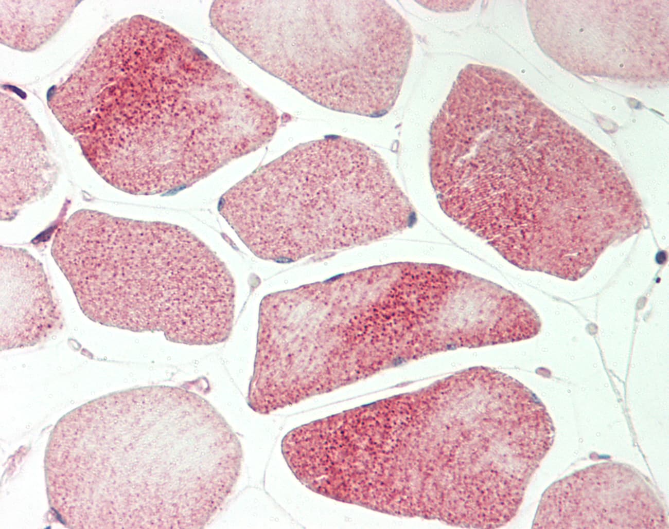 AXL Antibody (C-Terminus)