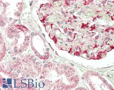 IHC-plus™ transmembrane channel-like 1 Antibody