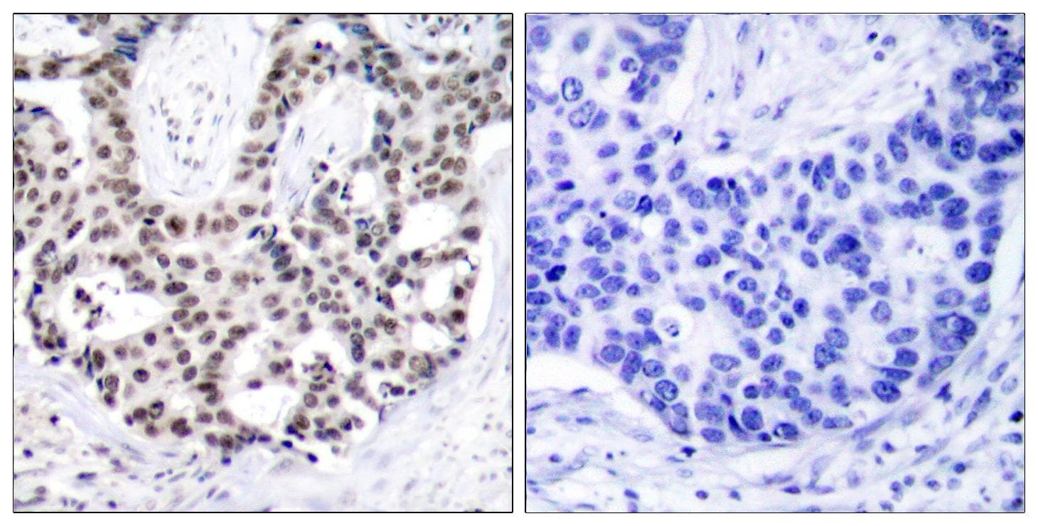 Polyclonal Rabbit anti-Human AR / Androgen Receptor Antibody (phospho-Ser650, IHC)