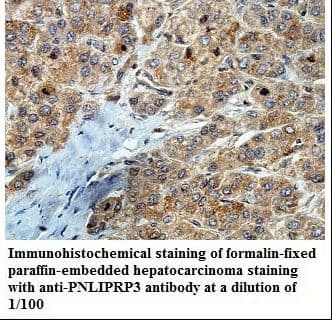 PNLIPRP3 Antibody (aa186-370)