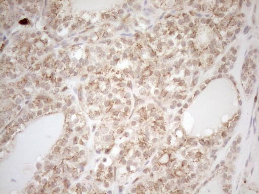 ZNF69 Antibody (clone OTI3C3)
