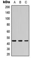 CSNK2A1 Antibody (Internal)