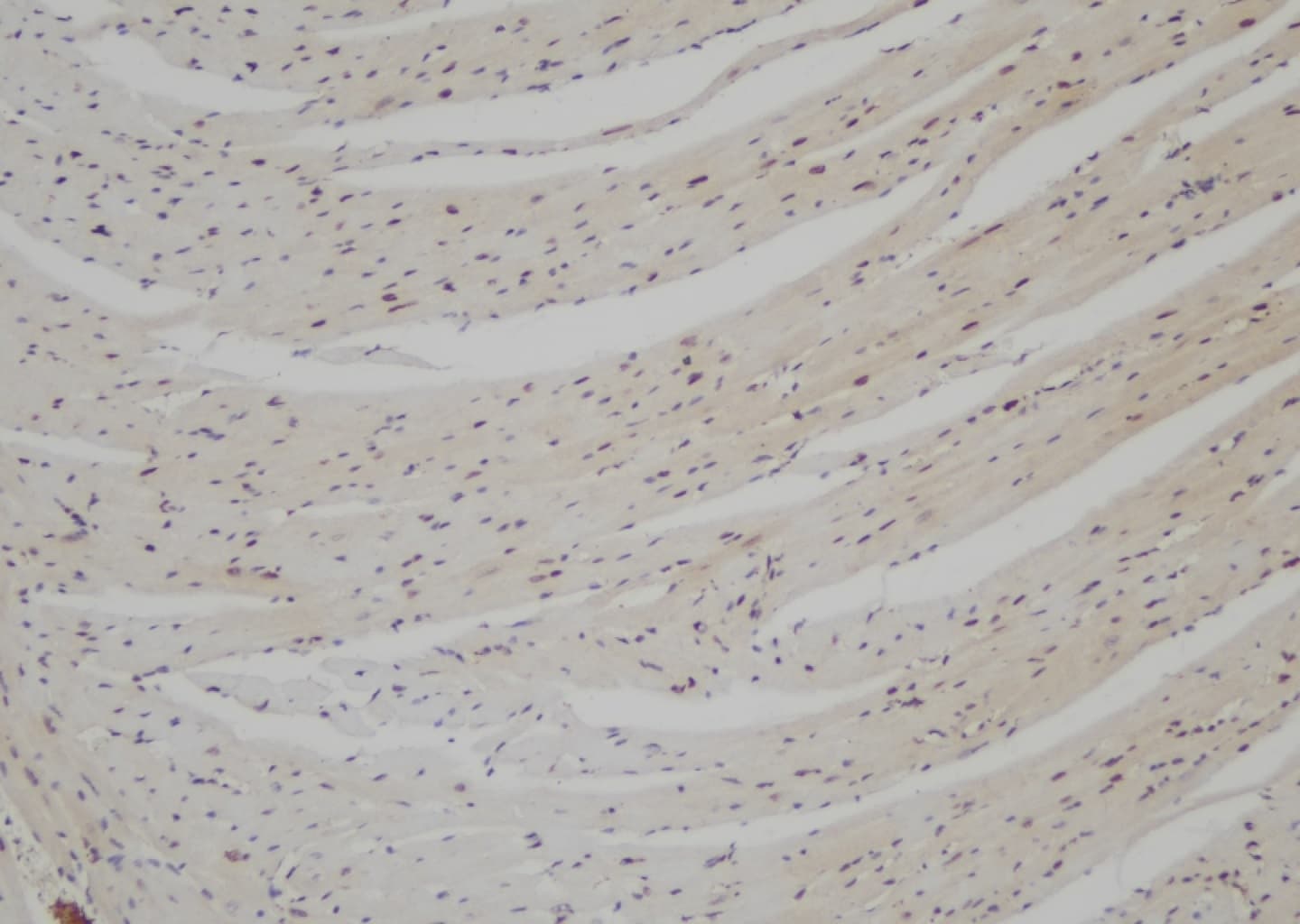 TNNI3K / CARK Antibody
