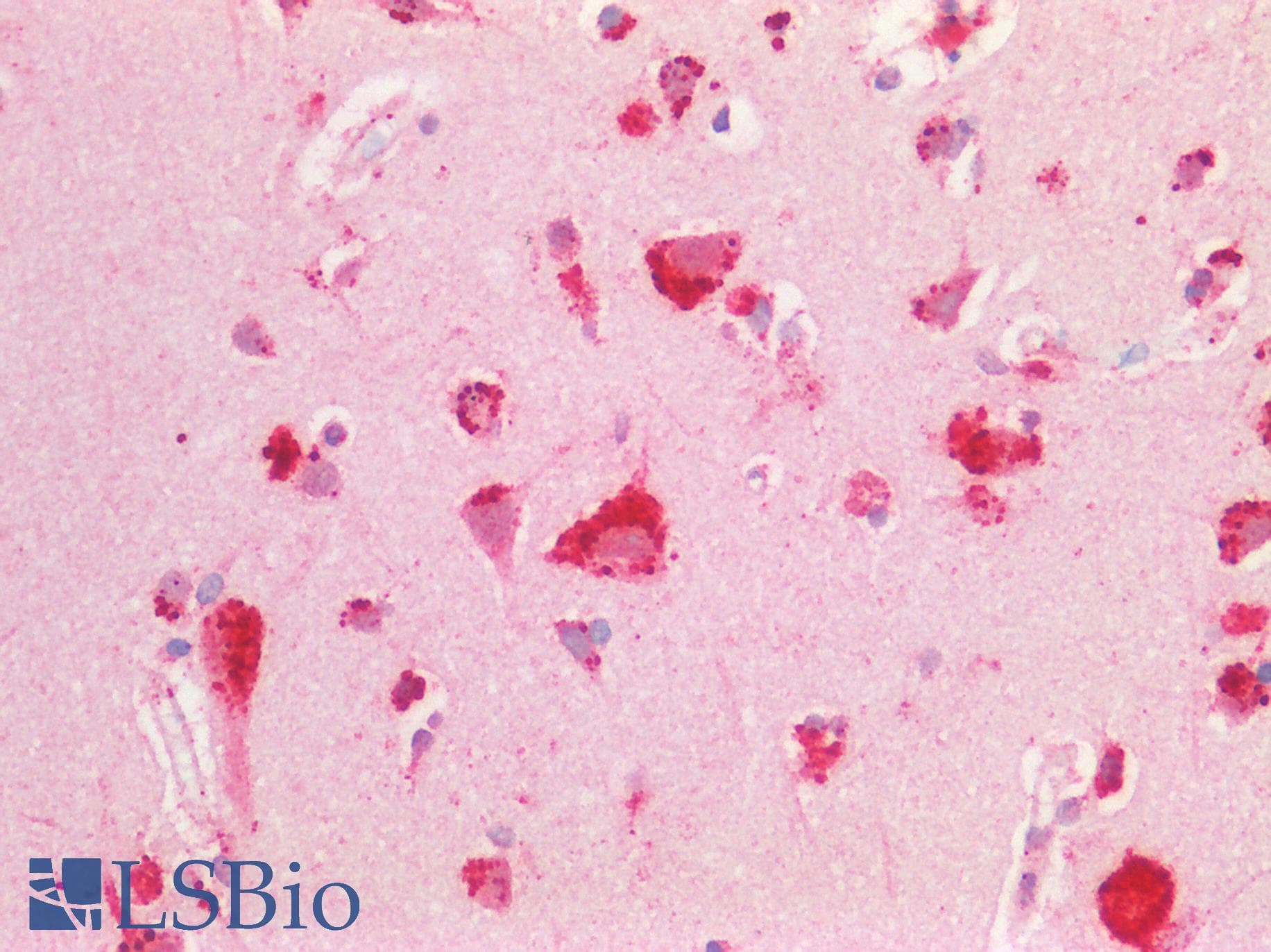 PPT1 / CLN1 Antibody (C-Terminus)