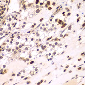 Polyclonal Rabbit anti-Human CEBPG / CEBP Gamma Antibody (IHC, IF, WB)