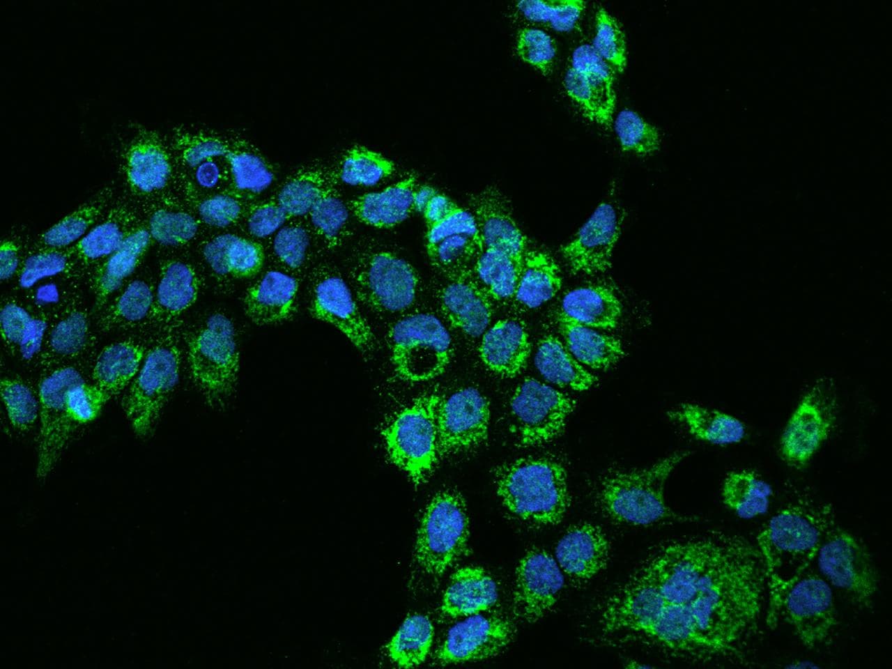 AARS2 Antibody