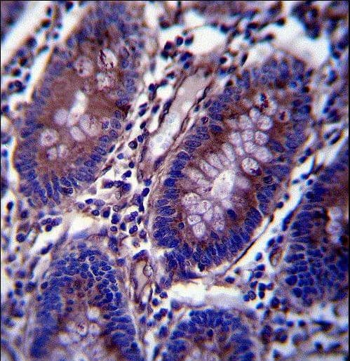Polyclonal Rabbit anti-Human Vimentin Antibody (aa430-457, IHC, IF, WB)