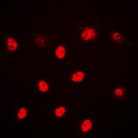 ALX3 Antibody (Internal)
