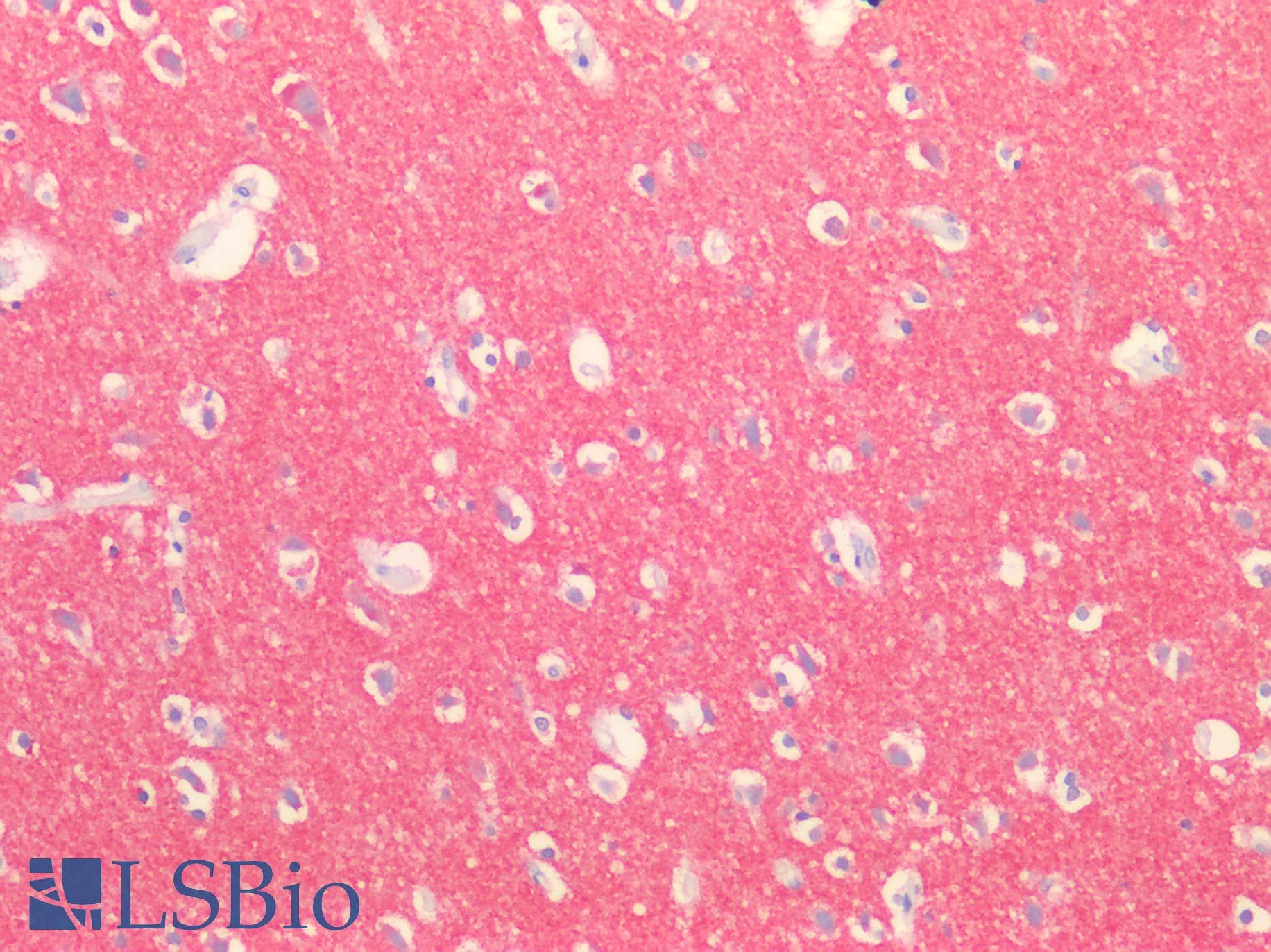 PathPlus™ SYN1 / Synapsin 1 Antibody (aa113-420)