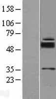 SLC39A11 / ZIP11 Protein (Over-Expression Lysate Myc-DDK (Flag))