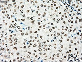 Monoclonal Mouse anti-Human TYRO3 Antibody (clone OTI2G2, IHC, WB)