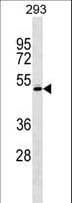 Polyclonal Rabbit anti-Human RCBTB1 Antibody (aa350-377, WB)
