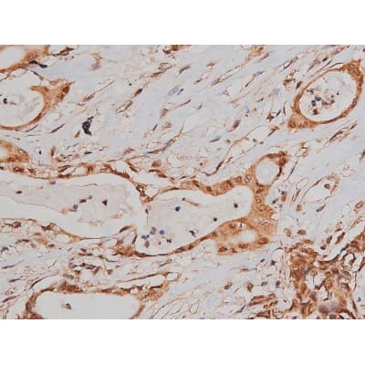 MAPT / Tau Antibody (phospho-Ser262)