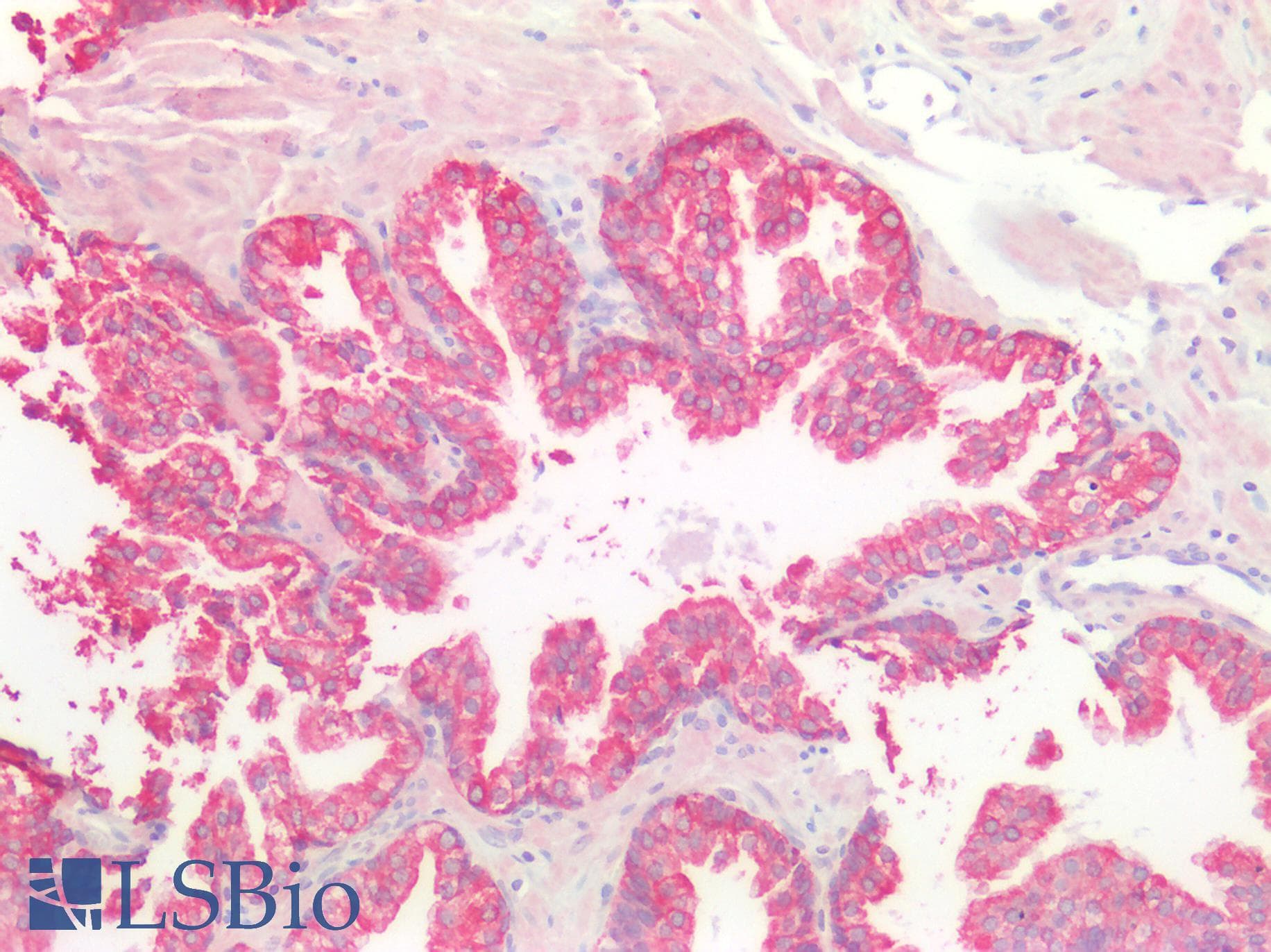 PathPlus™ KRT8 / CK8 / Cytokeratin 8 Antibody (aa2-483)