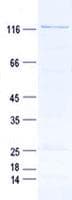 Human BAHD1 Protein (Recombinant GST, N-terminus + His, C-terminus)