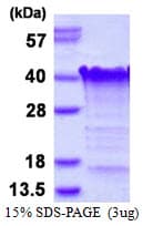 Human TCEAL3 Protein (Recombinant His)