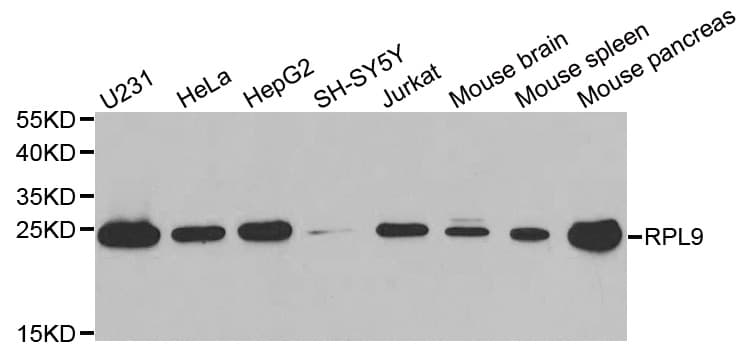 RPL9 / Ribosomal Protein L9 Antibody