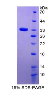 Rat FOXM1 Protein (Recombinant His-T7)