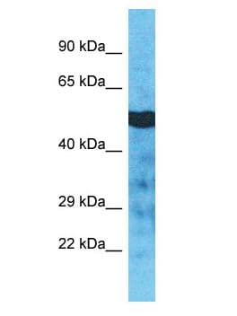TUBA3C / Tubulin Alpha 3C Antibody (aa399-448)