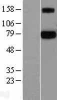 PROS1 / Protein S (Over-Expression Lysate Myc-DDK (Flag))