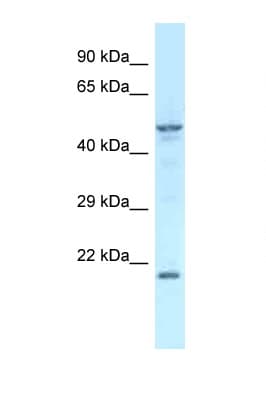 Zfp113 Antibody (aa200-249)
